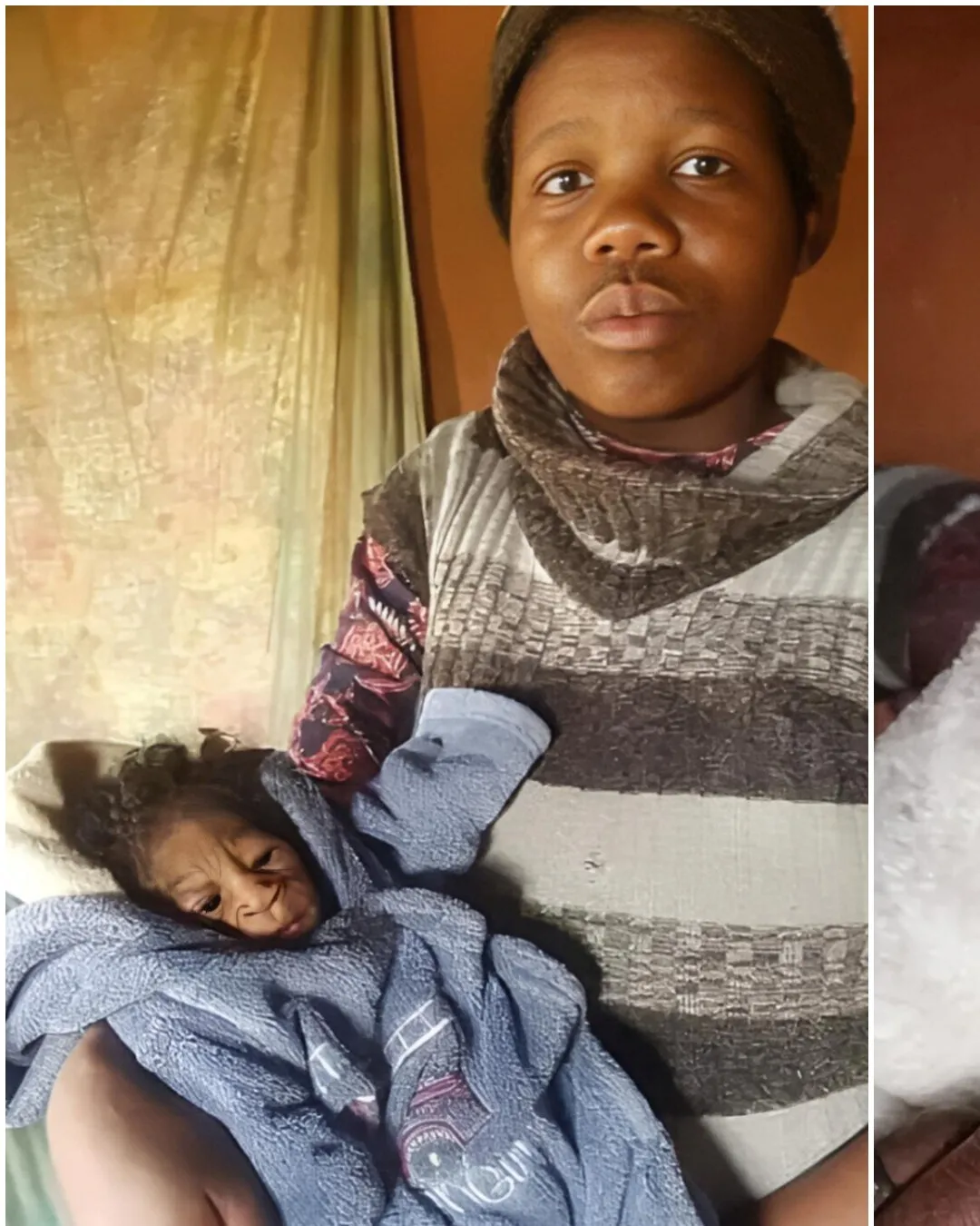 Baby Born with Rare ‘Benjamin Button’ Syndrome Defies Expectations: A Mother’s Journey of Love and Strength 7602