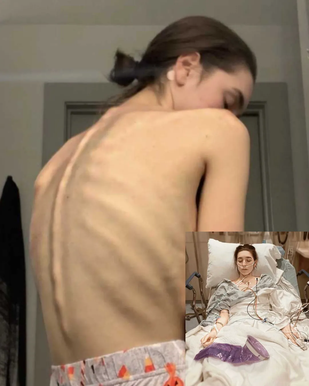 A Life of Pain, Persistence, and Hope: My Journey with MALS 7997