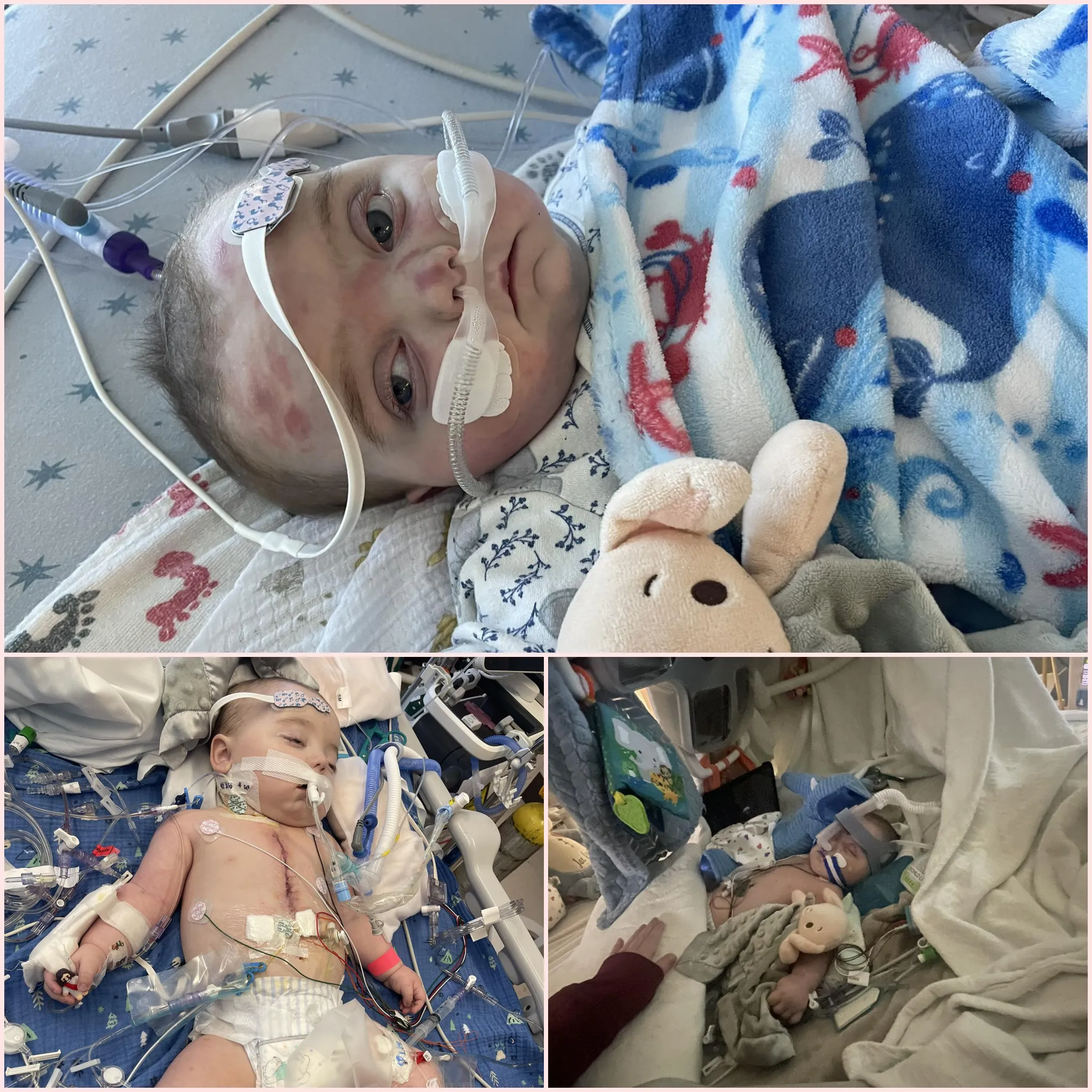 genz. “Our Hearts Are Broken”: Jax Suddenly Crashes After Surgery and Returns to ICU