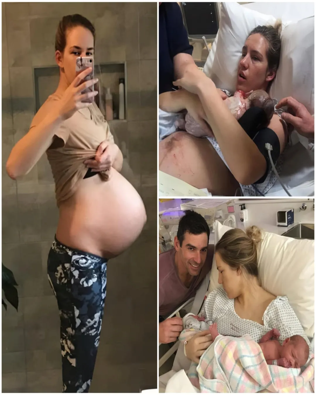 She Couldn’t Blink. She Couldn’t Smile. But She Delivered Twins With Unshakable Strength. 6813